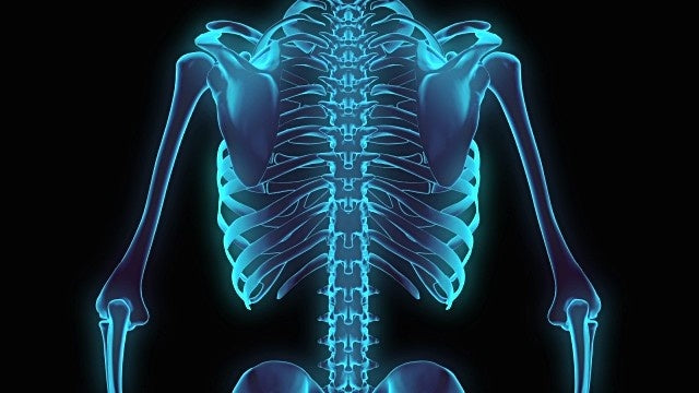 x ray homeopathy